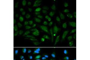 Immunofluorescence analysis of MCF-7 cells using Decorin Polyclonal Antibody (Decorin 抗体)