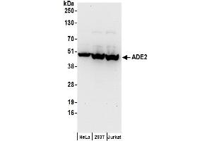 anti-phosphoribosylaminoimidazole Carboxylase, phosphoribosylaminoimidazole Succinocarboxamide Synthetase (PAICS) (AA 1-50) antibody
