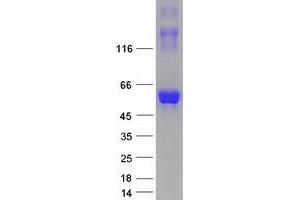 Validation with Western Blot