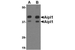 Western blot analysis of Aipl1 in rat brain tissue lysate with AP30037PU-N Aipl1 antibody at (A) 1 and (B) 2 μg/ml.