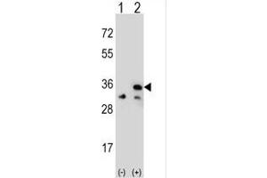 Western blot analysis of VDAC1 (arrow) using rabbit polyclonal VDAC1 Antibody (Center) (ABIN390564 and ABIN2840894). (VDAC1 抗体  (AA 95-124))