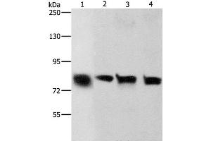 Western Blot analysis of Hela and A549 cell, Human liver cancer tissue and HT-29 cell using K-Cadherin Polyclonal Antibody at dilution of 1:500 (CDH6 抗体)