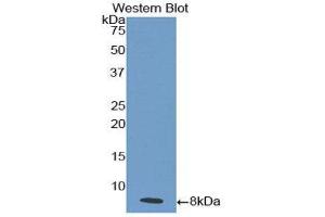 Western Blotting (WB) image for anti-Interleukin 18 Receptor 1 (IL18R1) (AA 375-428) antibody (ABIN1859374) (IL18R1 抗体  (AA 375-428))