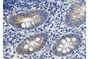 ABIN6267651 at 1/100 staining human Appendix tissue sections by IHC-P. (Caspase 8 抗体  (pSer347))