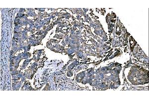IHC analysis of NEDD4 using anti-NEDD4 antibody (ABIN7599536).