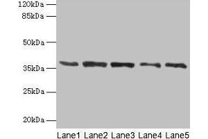 Western blot All lanes: PLAUR antibody at 4 μg/mL Lane 1: Mouse brain tissue Lane 2: A2780 whole cell lysate Lane 3: MCF-7 whole cell lysate Lane 4: Hela whole cell lysate Lane 5: Colo320 whole cell lysate Secondary Goat polyclonal to rabbit IgG at 1/10000 dilution Predicted band size: 37, 32, 33 kDa Observed band size: 37 kDa (PLAUR 抗体  (AA 23-305))