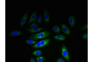 Immunofluorescent analysis of A549 cells using ABIN7157483 at dilution of 1:100 and Alexa Fluor 488-congugated AffiniPure Goat Anti-Rabbit IgG(H+L) (KHDC1 抗体  (AA 74-237))