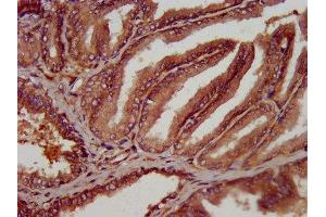 IHC image of ABIN7162139 diluted at 1:300 and staining in paraffin-embedded human prostate tissue performed on a Leica BondTM system. (Olfactomedin 4 抗体  (AA 224-334))