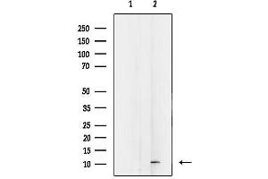 anti-Death-Associated Protein (DAP) (N-Term) antibody