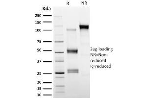 SDS-PAGE Analysis Purified Calpastatin Mouse Monoclonal Antibody (CAST/1550). (Calpastatin 抗体)