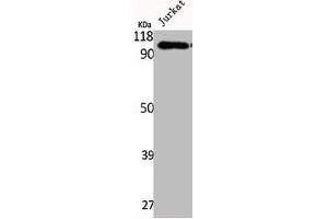 Western Blot analysis of Jurkat cells using Integrin β5 Polyclonal Antibody (Integrin beta 5 抗体  (C-Term))