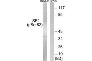 Western blot analysis of extracts from HUVEC cells treated with anisomycin using SF1 (Phospho-Ser82) Antibody. (Splicing Factor 1 抗体  (pSer82))