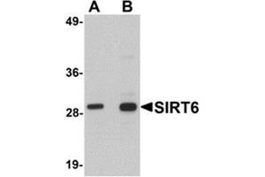 Western blot analysis of SIRT6 in HeLa cell lysate with SIRT6 antibody at (A) 0. (SIRT6 抗体  (C-Term))