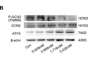 Western Blotting (WB) image for anti-Actin, beta (ACTB) antibody (ABIN3020544)