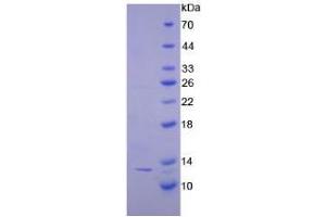 SDS-PAGE analysis of Human CTNNbIP1 Protein.