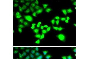 Immunofluorescence analysis of MCF-7 cells using RAD1 Polyclonal Antibody