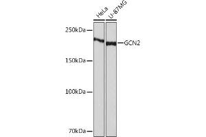 Western blot analysis of extracts of various cell lines, using GCN2 Rabbit mAb (ABIN1679532, ABIN3015972, ABIN3015973 and ABIN7101471) at 1:1000 dilution. (GCN2 抗体)