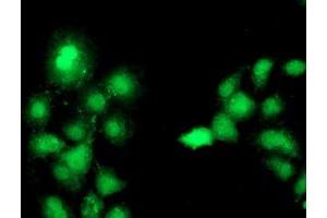 Anti-C1S mouse monoclonal antibody (ABIN2455417) immunofluorescent staining of COS7 cells transiently transfected by pCMV6-ENTRY C1S (RC218963). (C1S 抗体)