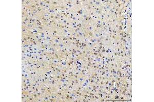 IHC analysis of RTF1 using anti-RTF1 antibody (ABIN7602444). (RTF1 抗体  (AA 77-705))