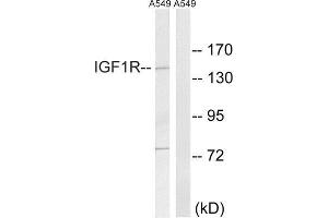 Western Blotting (WB) image for anti-Insulin-Like Growth Factor 1 Receptor (IGF1R) (Tyr1346) antibody (ABIN1848190) (IGF1R 抗体  (Tyr1346))