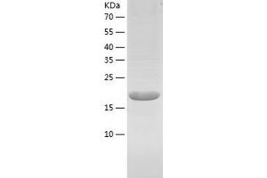 Calneuron 1 (CALN1) (AA 1-192) protein (His-IF2DI Tag)
