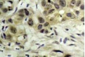 Image no. 3 for anti-Nibrin (NBN) (pSer343) antibody (ABIN318326) (Nibrin 抗体  (pSer343))