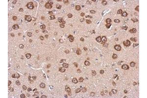 IHC-P Image Immunohistochemical analysis of paraffin-embedded CL1-5 xenograft, using cystatin F, antibody at 1:500 dilution. (CST7 抗体)