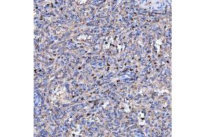 IHC analysis of RAB3GAP1 using anti-RAB3GAP1 antibody (ABIN7599702).