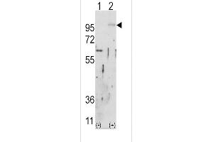 Western blot analysis of FGFR2 (arrow) using rabbit polyclonal FGFR2 Antibody (ABIN391968 and ABIN2841764). (FGFR2 抗体)