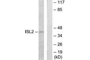 Western Blotting (WB) image for anti-ISL LIM Homeobox 2 (ISL2) (AA 161-210) antibody (ABIN2889718) (ISL2 抗体  (AA 161-210))