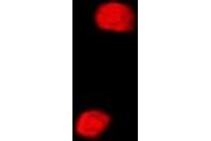 Immunofluorescent analysis of SETD5 staining in MCF7 cells. (SETD5 抗体)