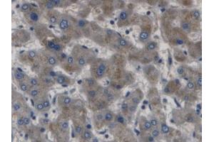 DAB staining on IHC-P; Samples: Human Liver Tissue (GABBR1 抗体  (AA 199-570))