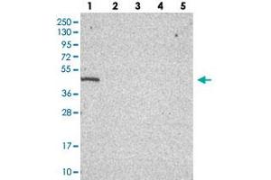 Western blot analysis of Lane 1: RT-4, Lane 2: U-251 MG, Lane 3: Human Plasma, Lane 4: Liver, Lane 5: Tonsil with C19orf47 polyclonal antibody  at 1:100-1:250 dilution. (C19orf47 抗体)