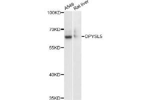 Western blot analysis of extracts of various cell lines, using DPYSL5 antibody (ABIN6291929) at 1:3000 dilution. (DPYSL5 抗体)