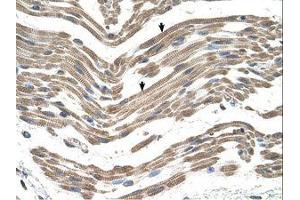 Image no. 1 for anti-Complement Component 1, Q Subcomponent, B Chain (C1QB) (C-Term) antibody (ABIN6738119) (C1QB 抗体  (C-Term))