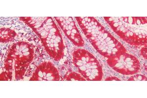 Detection of GAL3 in Human Colon Tissue using Polyclonal Antibody to Galectin 3 (GAL3) (Galectin 3 抗体)