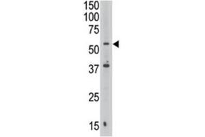 Western Blotting (WB) image for anti-Septin 9 (SEPT9) antibody (ABIN3002552) (Septin 9 抗体)
