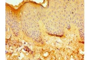 Immunohistochemistry (IHC) image for anti-Excision Repair Cross-Complementing Rodent Repair Deficiency, Complementation Group 2 (ERCC2) (AA 1-300) antibody (ABIN7171956)