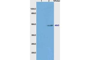 Lane 1: mouse spleen lysates Lane 2: mouse liver lysates probed with Anti caspase-8 subunit p18 Polyclonal Antibody, Unconjugated (ABIN1386778) at 1:200 in 4 °C. (Caspase 8 抗体  (AA 188-280))