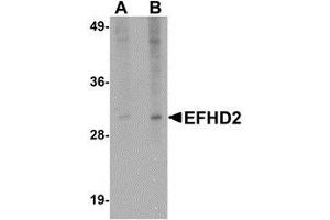Western blot analysis of EFHD2 in mouse brain tissue lysate with AP30310PU-N EFHD2 antibody at (A) 1 and (B) 2 μg/ml. (EFHD2 抗体  (N-Term))