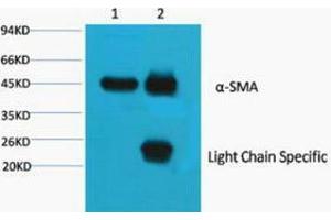 Immunoprecipitation (IP) analysis: 1) Input: Mouse Brain Tissue Lysate. (Actin 抗体)