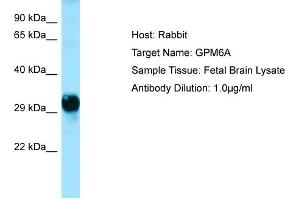 Host: Rabbit  Target Name: GPM6A  Antibody Dilution: 1. (GPM6A 抗体  (C-Term))