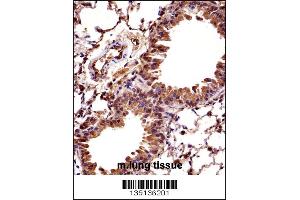 Mouse Hoxc10 Antibody immunohistochemistry analysis in formalin fixed and paraffin embedded mouse lung tissue followed by peroxidase conjugation of the secondary antibody and DAB staining. (HOXC10 抗体  (C-Term))