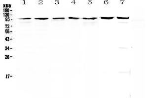 Western blot analysis of Topoisomerase I using anti-Topoisomerase I antibody . (Topoisomerase I 抗体  (AA 526-765))