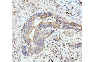 IHC analysis of GIT1 using anti-GIT1 antibody (ABIN7601683). (GIT1 抗体  (AA 415-736))