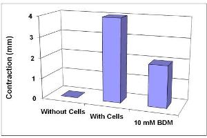 Contraction inhibition by BDM.