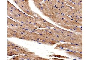 IHC analysis of ACTN2 using anti-ACTN2 antibody (ABIN7602055). (ACTN2 抗体  (AA 567-696))