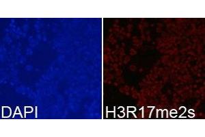 Immunofluorescence analysis of 293T cell using H3R17me2s antibody. (Histone 3 抗体  (H3R17me2s))