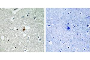 Peptide - +Immunohistochemistry analysis of paraffin-embedded human brain tissue usingantibody. (TCF3 抗体  (Internal Region))