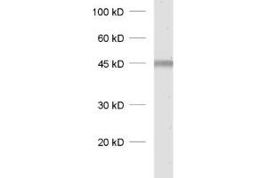 dilution: 1 : 1000, sample: rat spinal cord homogenate (CAMK1 抗体)